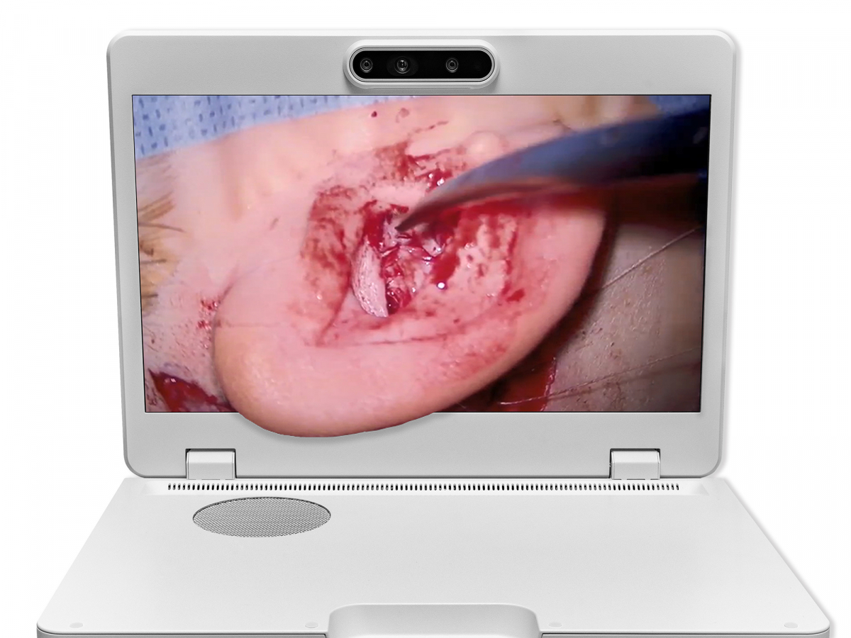 达擎之＂Heads-up 3D显微手术显示系统＂，整合4K裸眼3D显示及眼球追踪系统，具备快速追踪人眼移动位置功能，减轻医师长时间维持固定姿势的负担，让医师能有更宽广清晰的3D立体视野及更舒适的姿势来执行手术。